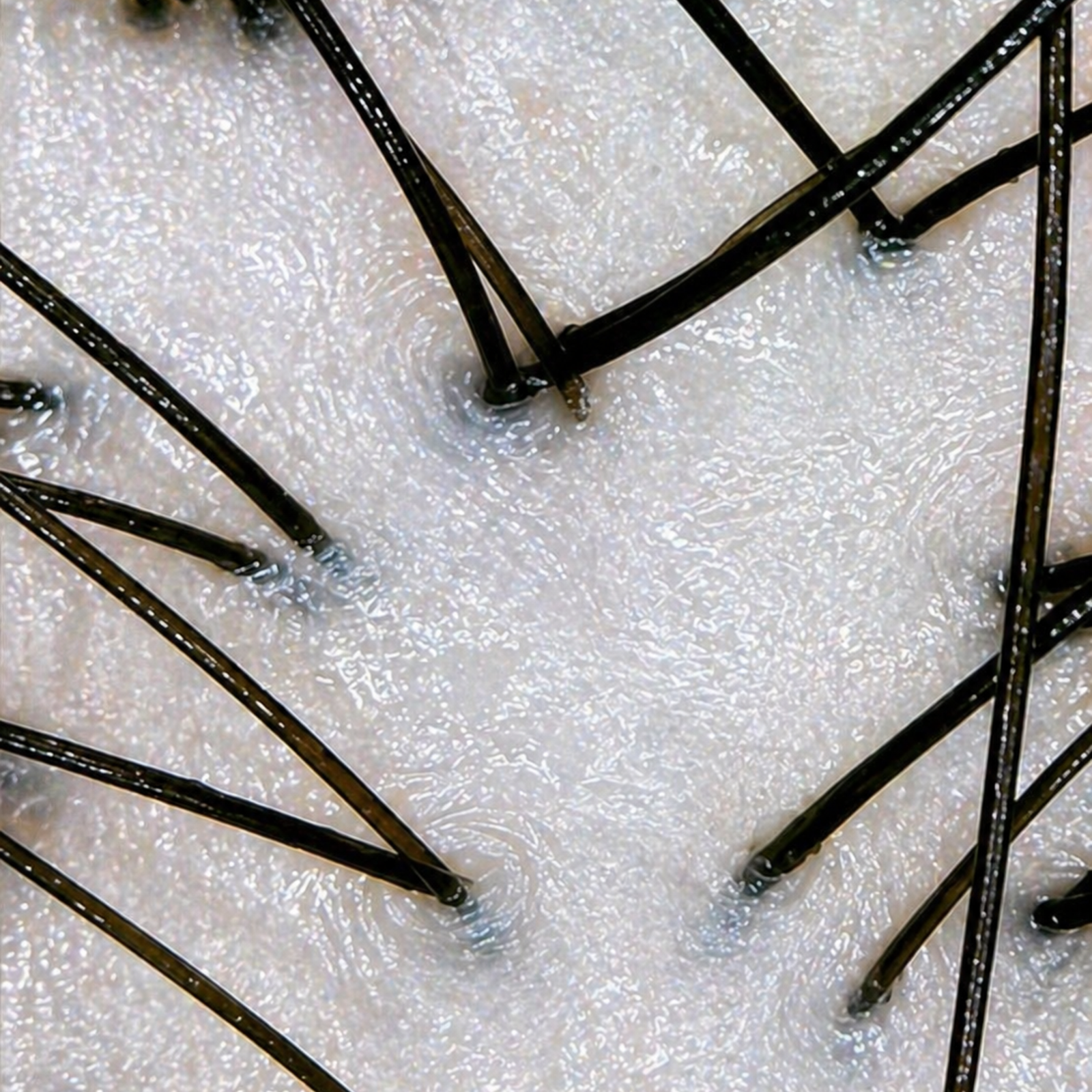 Po tretmaju — čisto lasišče